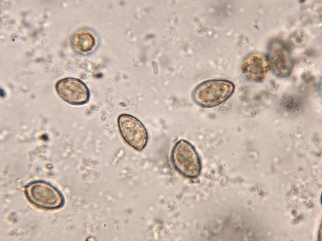 Cortinarius ochropallidus?